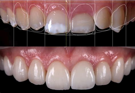 avant smile dental clinic